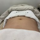 석뷰티 | 복부관리 1회차 변화 후기 샵토탈뷰티살롱 신부동피부관리