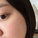 셀리즈피부과의원 | 부산 센텀시티 피부과 리프팅 후기!