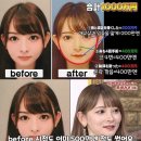 성형수술에 1500만엔 쓴 일본 여자 이미지
