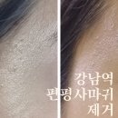 강화성지 | 강남역 한의원 편평사마귀 제거 성지 방문 후기