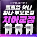 네이치과기공소 네이버블로그