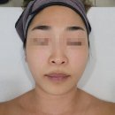 평택성동초등학교 | 평택피부관리 에멜리아 평택에스테틱 오투덤산소테라피 후기