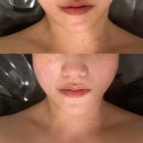 청주 윤곽관리 10주년 맞이한 에스테티아 후기