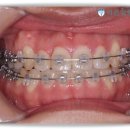 더바른치과기공소 이미지