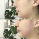 더예뻐지는샵 - 노원구 동일로195길 7 | 광주 북구 리프팅 추천 | 문흥동 예뻐지는샵에서 관리 받고 온 예신 후기