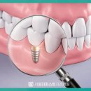 참한이치과의원 이미지