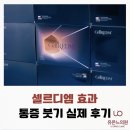 신촌 피부과 셀르디엠 효과 통증 붓기 모공개선 후기