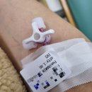 서울권이비인후과의원 | 나를 6년째 괴롭힌 일진 새끼 박동성에 대한 썰 푼다! 나한테서 떨어져라 박동성이명 ㅋ