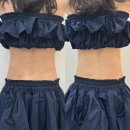 도구로1길 75 | 정관 체형관리 잘하는곳｜정관바디관리 라니뷰티 복부빼빼관리 후기