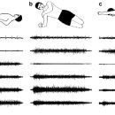 Immediate effects of co-contraction training on motor control of the trunk muscles in people with recurrent low back pain 이미지