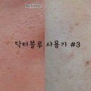 블루닥터 이미지