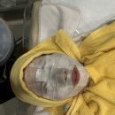 6122 | 에스테틱공간 : 강남역에스테틱 연예인의 피부관리 성지 관리 리얼 후기 🍒