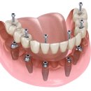 성치과의원 이미지