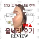 300 | 30대 피부과 시술 추천 내돈내산 강남피부과 울쎄라 300샷 후기