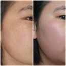 대동황토방아파트 앞 버스정류소 | 창원잡티제거 잘 하는 대방동 에스테틱 이뻐지움