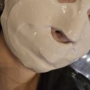조피부과의원 | 대전 피부과의원 스킨보톡스 부작용 내돈내산 후기