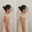제니스킨케어 | 울산 삼산 피부관리 추천｜아뜰리에드 스킨 라운드숄더·제니 어깨라인 케어 후기