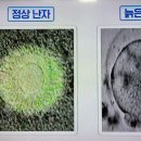 몸신의 여성호르몬생리, 난소기능회복법 이미지