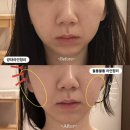 아름하다 | 청주 얼굴경락 효과좋은 아름하다 만족후기(웨딩관리)