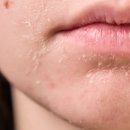 릴리성형외과의원 | [공지] 청담연예인피부과 인기시술 TOP 3 (특가이벤트)