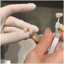 지원치과 기공소 이미지