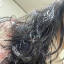 봉봉성형외과의원 | 모제림샴푸 SOS메가 탈모샴푸 집에서도 두피관리!