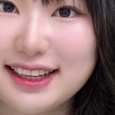어바웃 알린