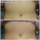 제석초등학교 | 광주) 올가드림뷰티 봉선점 복부 림프 &amp; 디톡스 관리 후기