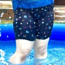 (주)바이오라이즈 | 부산허벅지지방흡입 16주차 허벅지 뚱땡이 탈출 성공