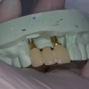 거성치과기공소 이미지