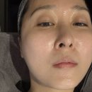 불독 | 30대 온다리프팅 후기와 턱살 불독살 고민 비포앤애프터
