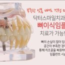 좋은날치과의원 네이버블로그