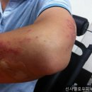 논현동피부과 신사멜로우피부과의원 친절한 상담이 좋았어요