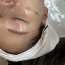 영진제우스(양정타임스퀘어빌딩) | 부산양정 스킨플래닝 잘하는 곳, 미채
