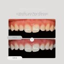 서울고운미소치과교정과치과의원 이미지