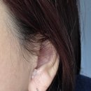 이혈 테라피 | 귀지압패치로 시작하는 데일리 케어, 이혈테라피 이혈기석 후기