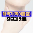 본아한의원 | 목이물감, 목에 뭔가 걸린 느낌 이유 | 매핵기 원인과 치료