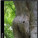 몽고반점 이미지