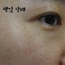 리본스화장품 | 광주 피부관리 : 모공 주름개선~