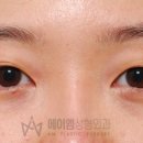 에이엠성형외과의원 이미지