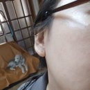 케어큐 | ✨ 기미패치 추천 패치큐 기미케어 솔직 후기