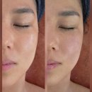 건원대로 | 구리피부관리 어반에스테틱에서 윤곽관리 후기