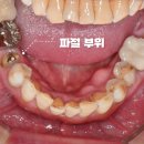 수원탑플란트치과의원 이미지