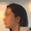 스킨송에스테 | w.8-2ᰔ [내돈내산]웨딩관리(스킨송에스테)10회 관리 솔직후기💆🏻‍♀️