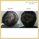 일러스라인 이미지