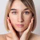 디파인피부과의원 이미지