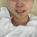 브이 | 하단 피부과 엑셀브이 레이저 후기
