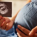 CW-2098-01 이미지