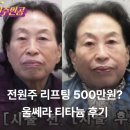 서우림 | 전원주 리프팅 시술 비용 500만원? 청담동 피부과 울쎄라 티타늄 후기