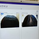 홈플러스 작전점 | 부평 탈모 고민 닥터모락 작전점 방문 후기